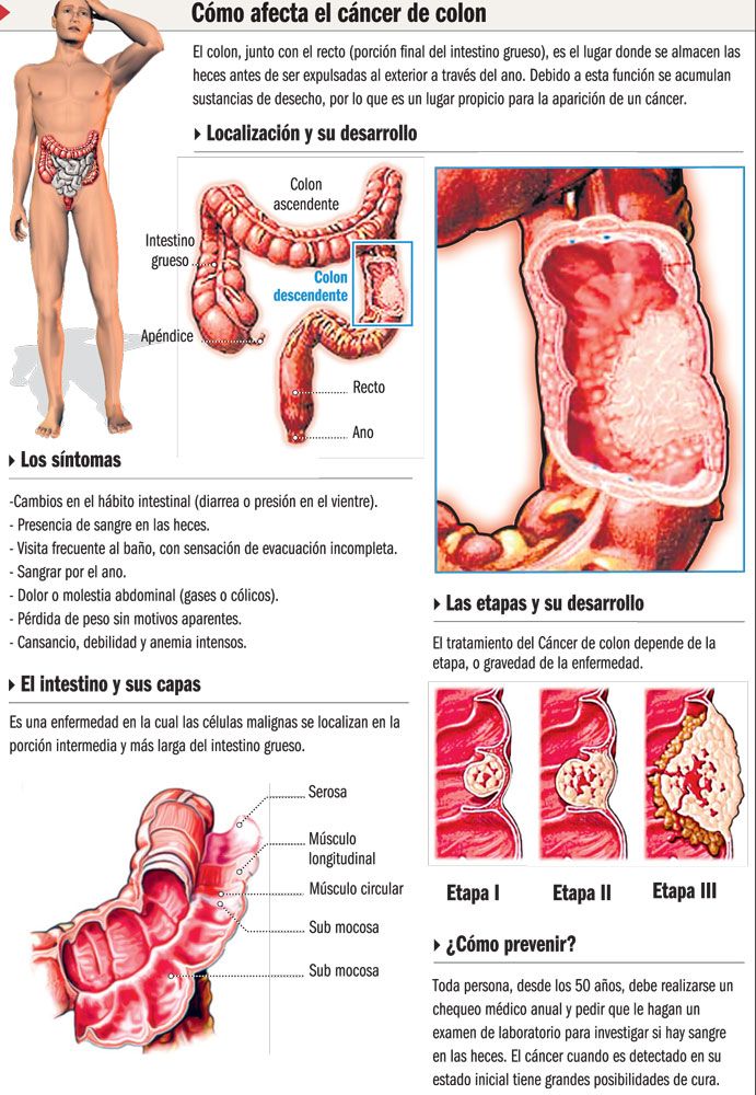 TheEnemaMachineAComprehensiveGuide 73 6770