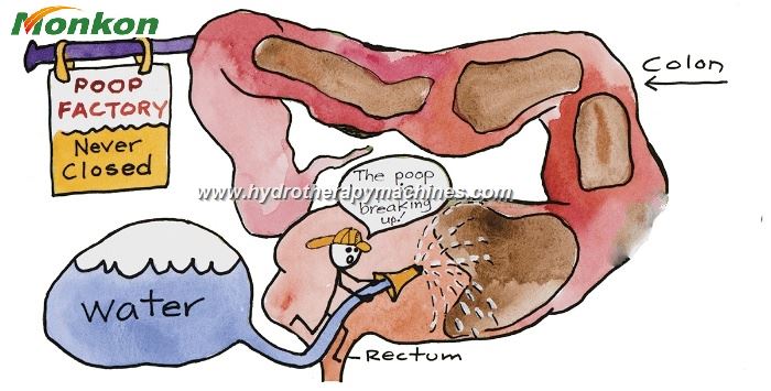 ColonHydrotherapyMachineforSaleTheUltimateGuide 73 a0ec